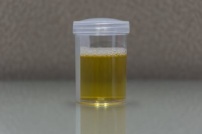 Urine sample